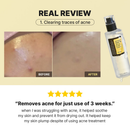 (COSRX Original)Advanced Snail 96 Mucin Powerful Essence 100ml 96,3% de filtrado de secreção de caracol para antienvelhecimento e nutritivo antirrugas